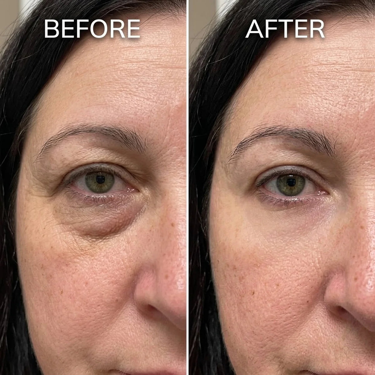 Rapid Reduction Serum